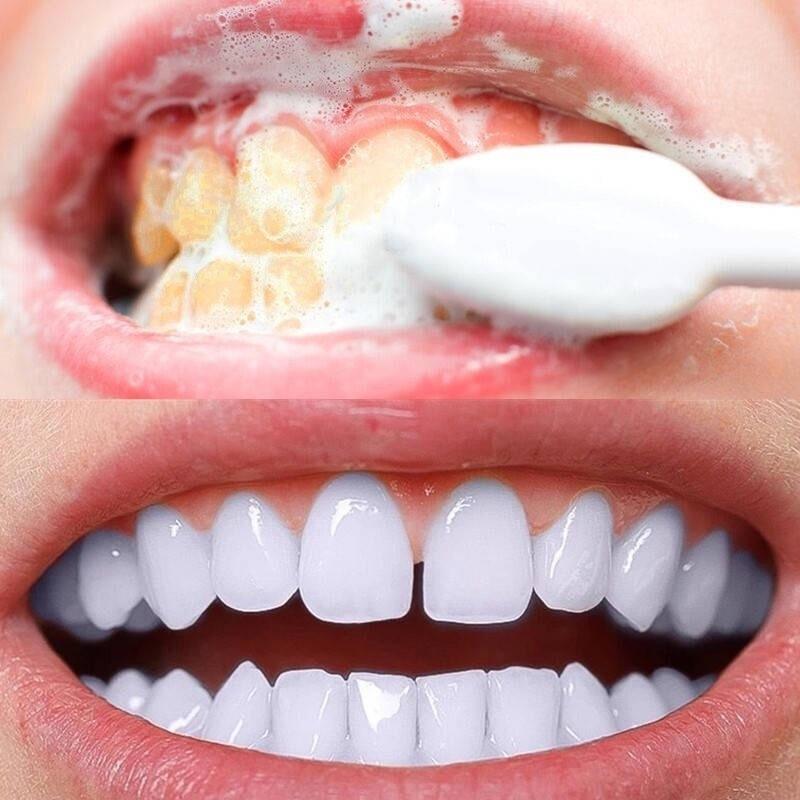 dentes brancos